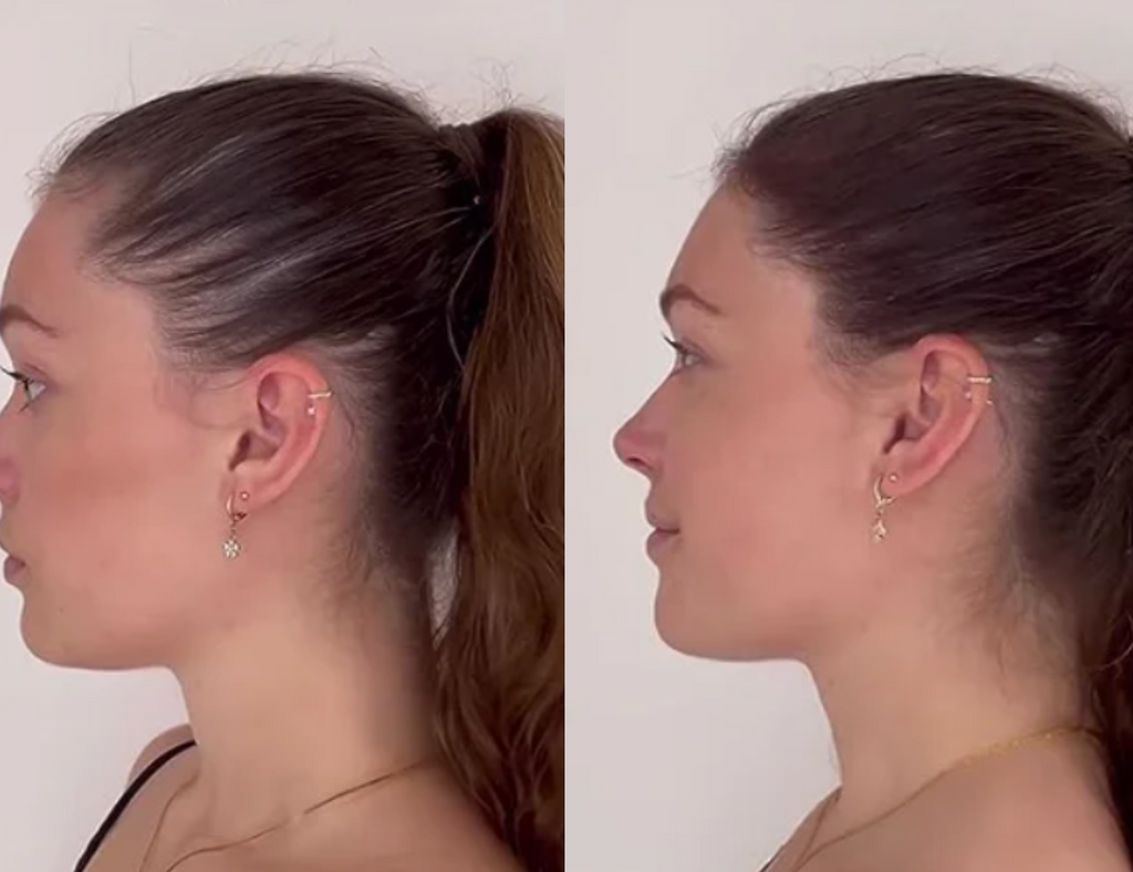 Lustrao Complete Regrowth System