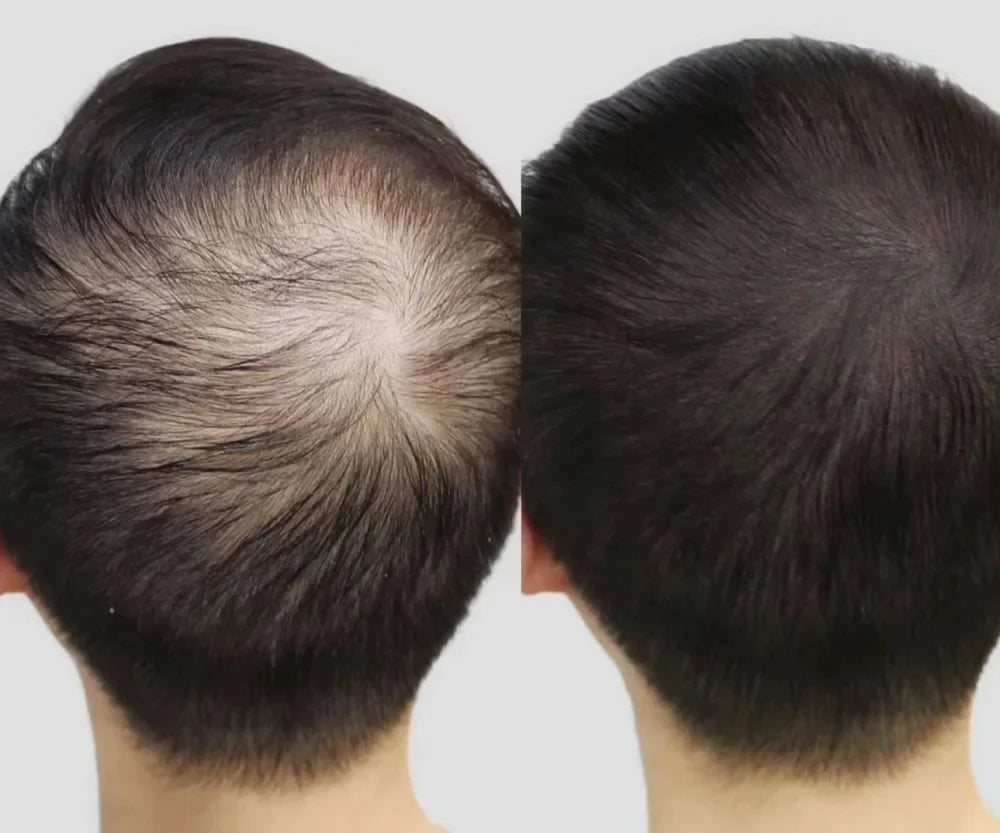 Lustrao Complete Regrowth System